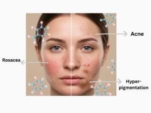 Benefits of azelaic acid