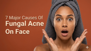 causes of fungal acne
